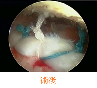 TR-03-04-img03.jpg